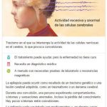 epilepcia informacion